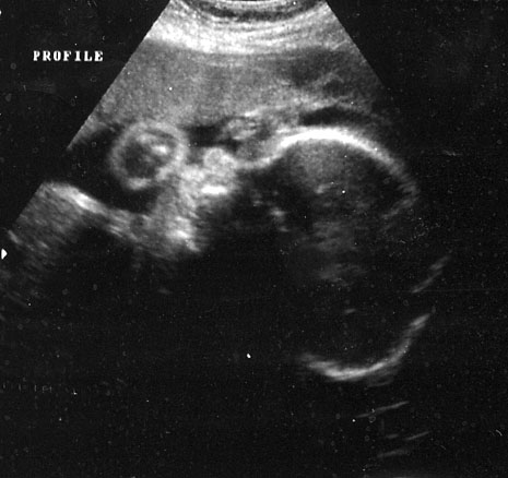 m-28-week-ultrasound.jpg