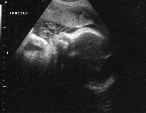 m-last-ultrasound-at-36-weeks.jpg