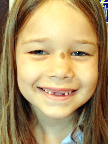 first-grade-toothless.jpg